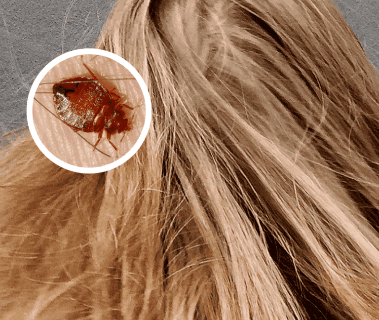 las chinches se suben al cabello 2022