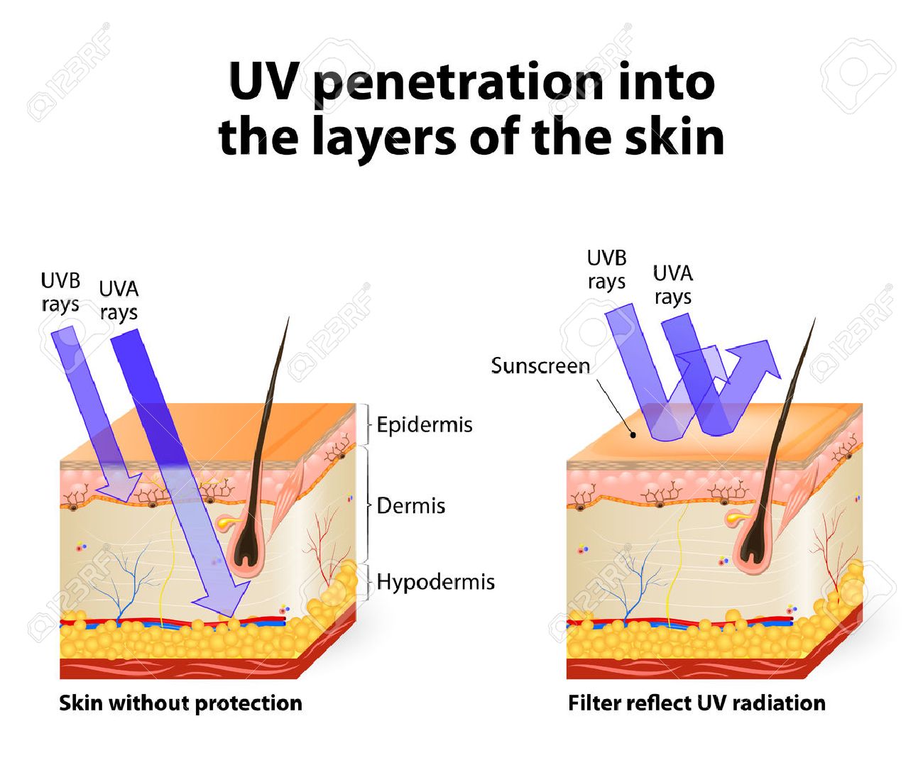 Luz ultravioleta penetrando en la piel humana