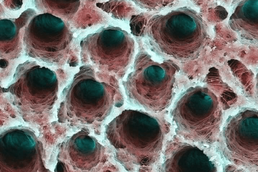 Biopelícula dental bajo el microscopio electrónico