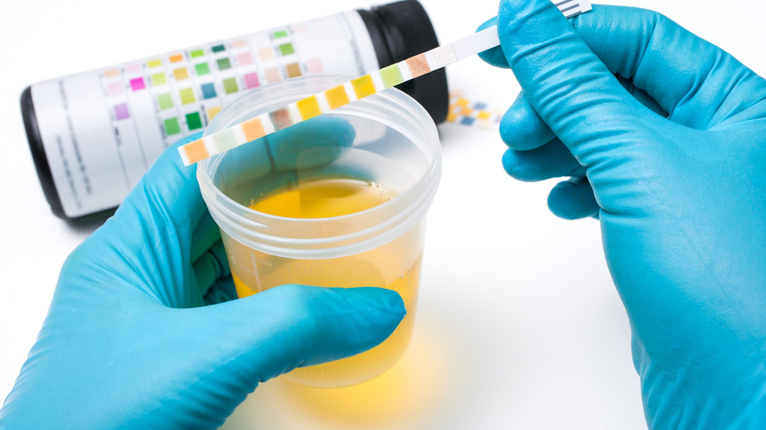 Pruebas de orina en laboratorio médico