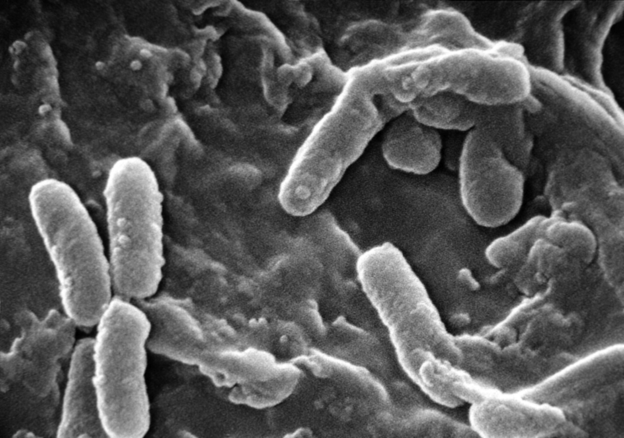 Bacteria Pseudomona aeruginosa bajo microscopio electrón
