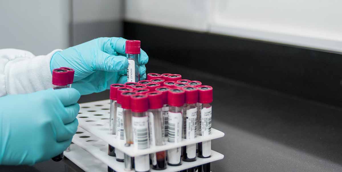 Almacenamiento adecuado de muestras de superficie