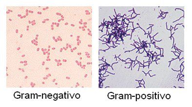 Bacterias Gram positivas vs Gram negativas en tinción