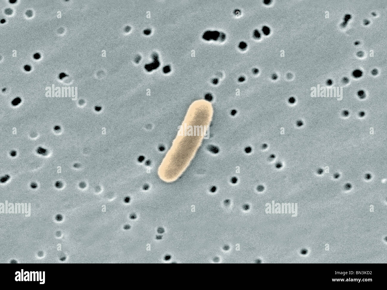Microscopía electrónica de bacterias Gram negativas