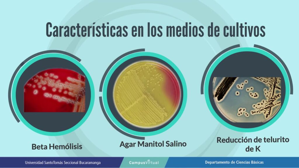 Cómo detectar toxina de Staphylococcus aureus en alimentos