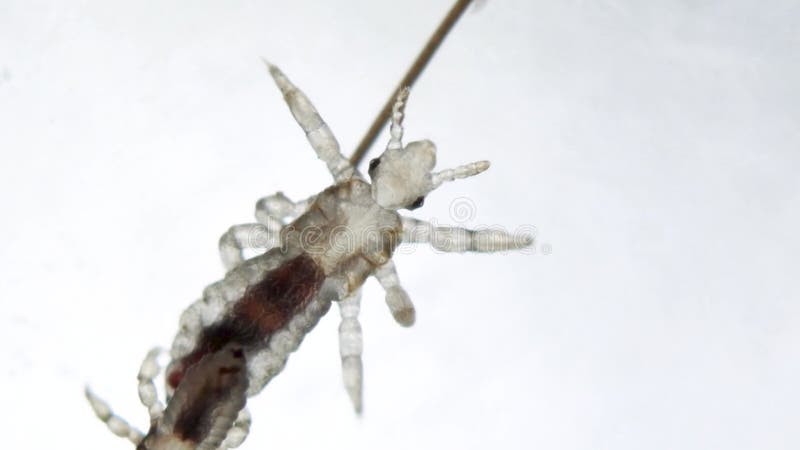 Piojos en el cabello humano en detalle