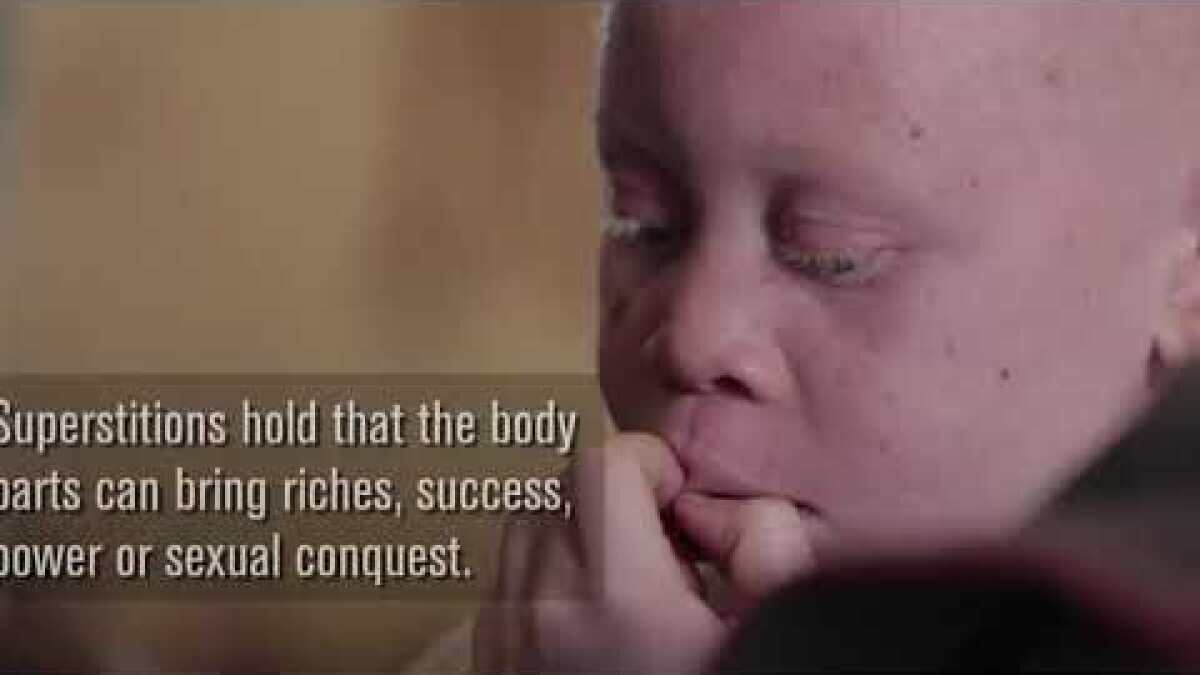 Mapa mundial de tasas de albinismo